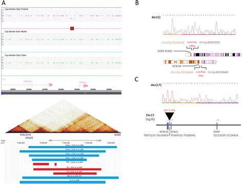 A Results of SNP-Array analysis in the patient and her parents. Copy... | Download Scientific ...