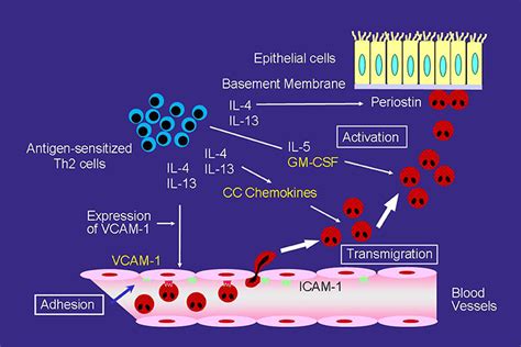 Eosinophiles Asthma