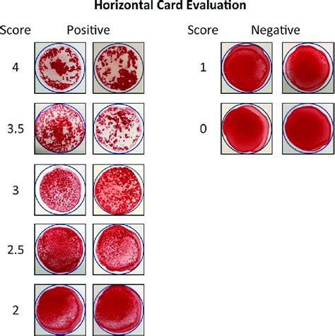 Hemagglutination can be scored for reaction strength. Scores were ...