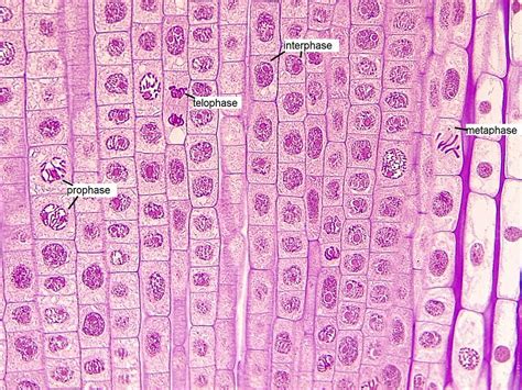 Onion Root Cell Mitosis Labeled - Juventu dugtleon