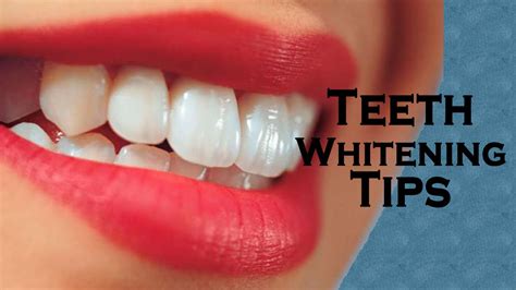 Teeth Whitening Home Remedies - Easy Tips For Teeth Whitening At Home - Beauty Pageant #13 - YouTube
