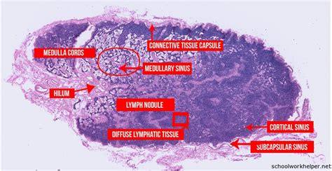 Lymph-Node–slide-labelled-histology | SchoolWorkHelper