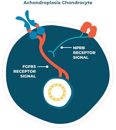 Achondroplasia, a Type Of Dwarfism | Causes & Facts