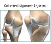 Collateral Ligament Injuries | eOrthopod.com