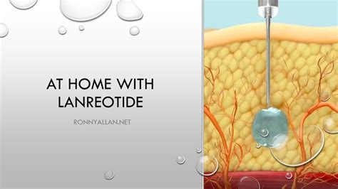 At home with Lanreotide - Ronny Allan - Living with Neuroendocrine ...