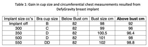 Ideal Implant Size Chart