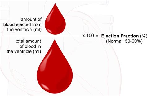 The Lowest Ejection Fraction a Person Could Live With? » Scary Symptoms