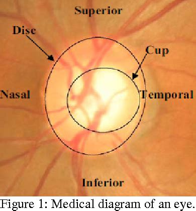 Figure 1 from Enhancement of optic cup to disc ratio detection in ...