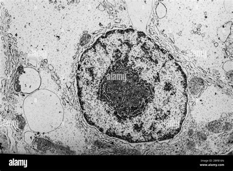 Cell Nucleus Electron Microscope