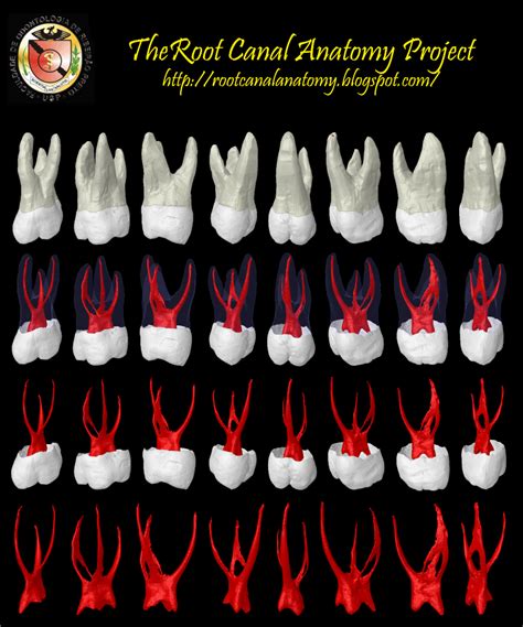 The Root Canal Anatomy Project: Maxillary First Molar