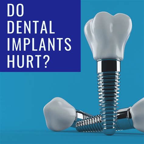 The 3 Steps to All-on-Four Implants | Chicago Dental Implants