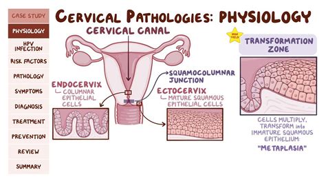 Cervical Canal