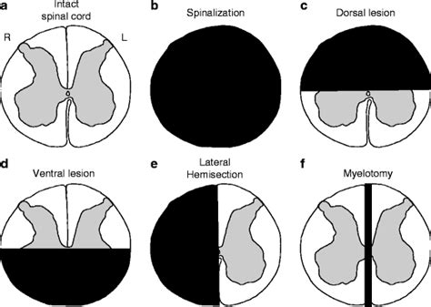 The Cat Model of Spinal Cord Injury | Veterian Key