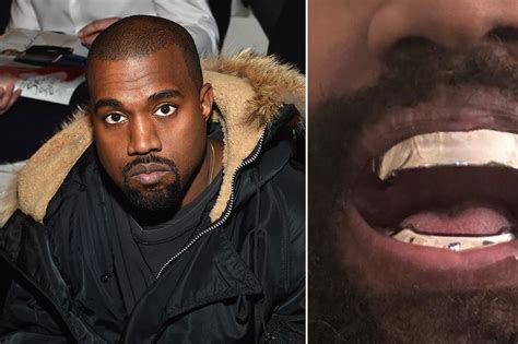 Kanye West debuts bizarre $850,000 titanium grills after having his ...