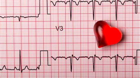 Simple Guidance For You In Home Healthcare [Can An Ekg Detect A Heart ...