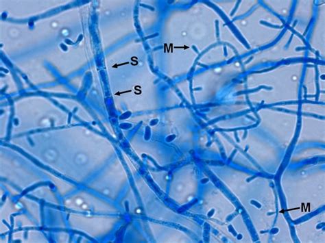 Fun With Microbiology (What's Buggin' You?): Microsporum audouinii