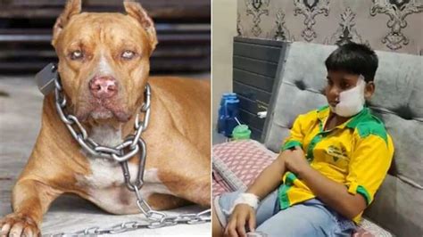 Ghaziabad: Pitbull dog bites 10-year-old boy's face and ears; victim ...