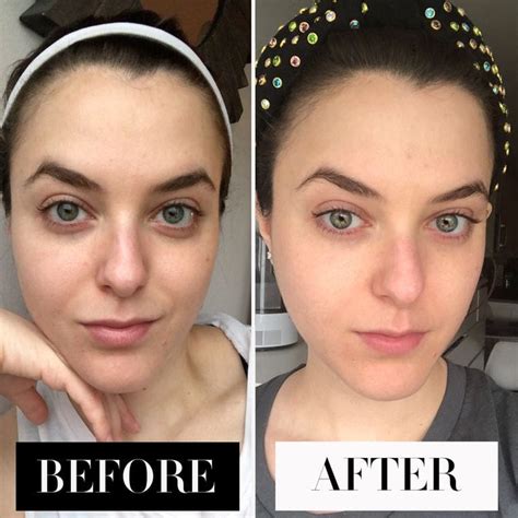 I Used Only Kylie Skin Products For a Whole Week. Here's My Honest ...