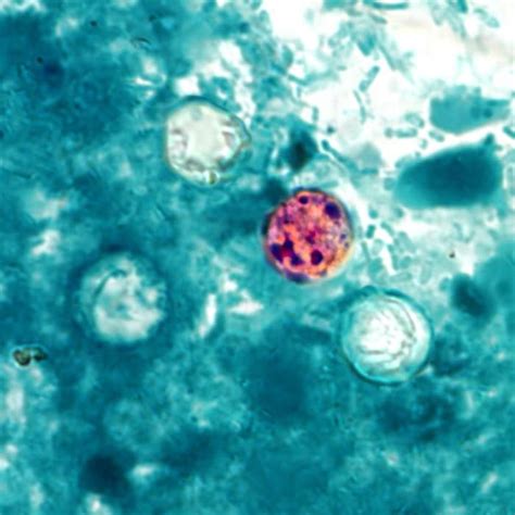 Cyclospora cayetanensis - Agentes biológicos - Parásito