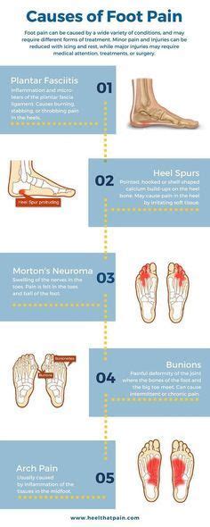 Foot pain chart: Do you know what's causing your foot pain? It may be one of a number of ...