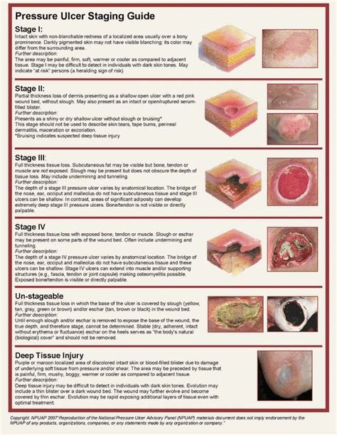 New guidance on defining and measuring pressure ulcers