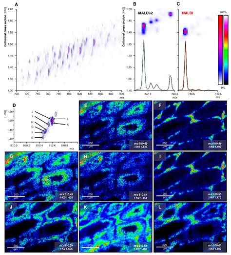 Mass spectrometry imaging - 2020 - Wiley Analytical Science