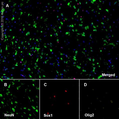 Results for "neun" | Abcam: antibodies, proteins, kits...