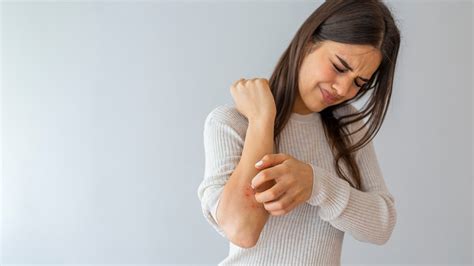 Can Eczema be Caused by Stress? - Eczema Clinics Australia