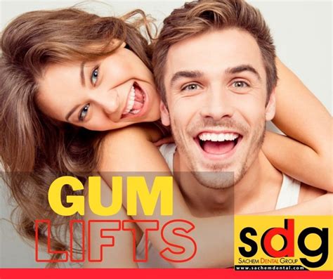 The Gum Lift Procedure - Sachem Dental Group