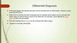 Hallux valgus Deformity | PPT