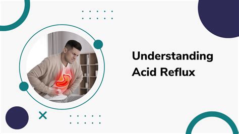 Understanding Acid Reflux: Causes, Symptoms, and Effective