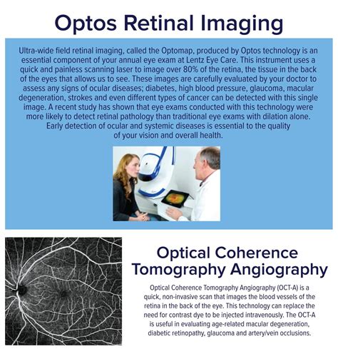 Optos Retinal Imaging