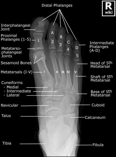Pin on Radiographic Anatomy
