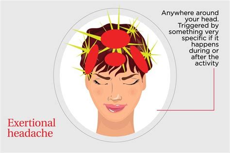 8 Types of Headaches—and How to Get Rid of Them ( courtecy;-Reader's ...