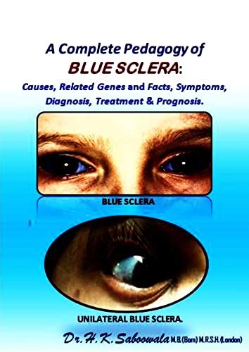 A Complete Pedagogy of BLUE SCLERA: Causes, Related Genes and Facts ...