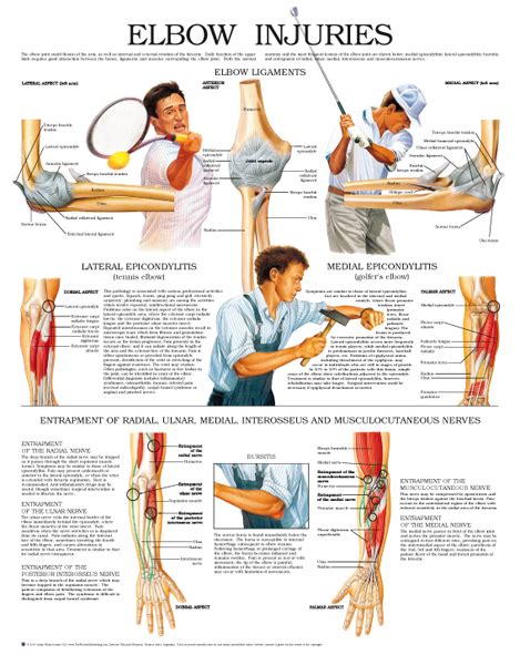 Elbow-injuries – Anejo