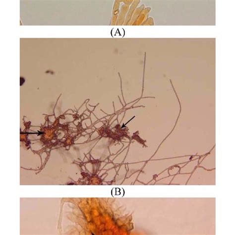 Light micrographs of (A) primary hyphae with dichotomous branches which ...