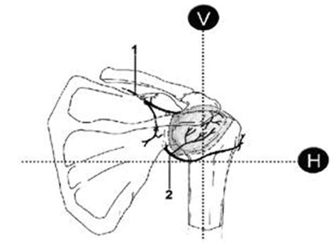 Combined Suprascapular and Axillary (Circumflex) Nerve Block: The ...