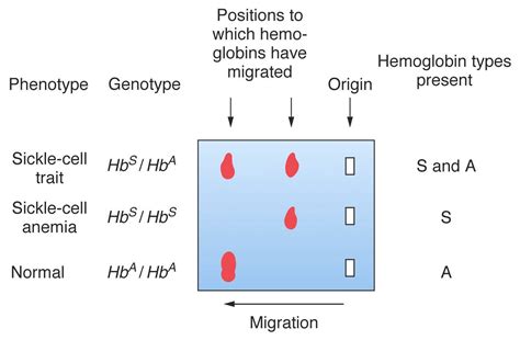 Hemoglobin Electrophoresis Sickle Cell | My XXX Hot Girl