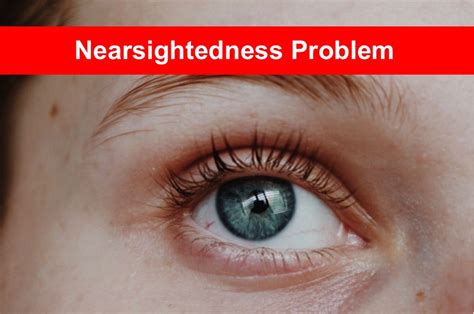 Nearsightedness Problem