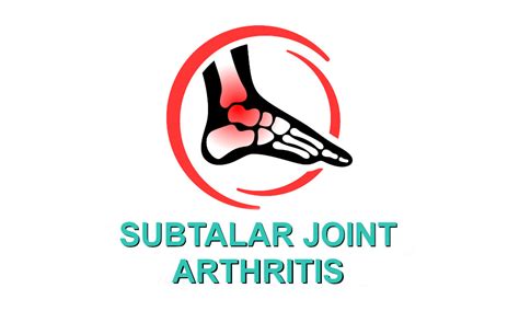 Subtalar joint arthritis! Avoid joint fusion with these treatments?