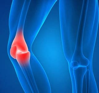 Knee Injury Treatment Grand Junction CO | Knee Dislocation Mesa County