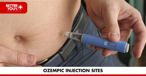 Ozempic Injection Points: Proper Administration Locations