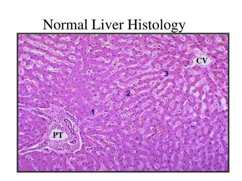 Fatty liver medicine information | Variuos