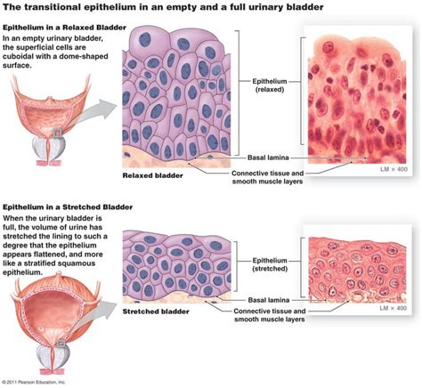 Pin by Erika Menchaca on Human Anatomy | Bladder, Transitional, Biology