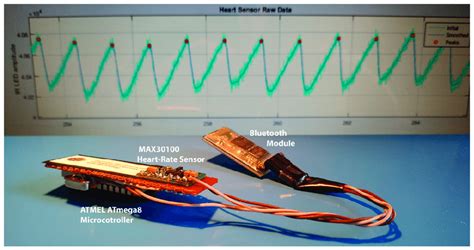 Prototype photoplethysmography electronic device. | Download Scientific Diagram