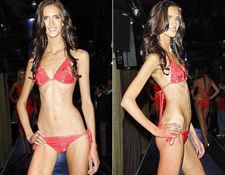 Size zero row over 'super skinny' model | Metro News