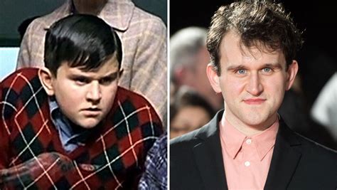 Harry Melling As Dudley Dursley Then And Now - Viral Gala