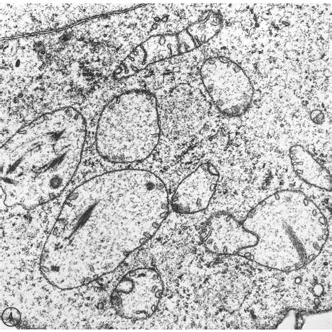 Greatly enlarged mitochondria in cells grown in the presence of EB for... | Download Scientific ...