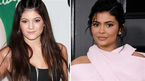 Kylie Jenner's Transformation: Personal Life & Career - OtakuKart